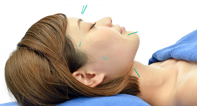 美顔鍼(美容鍼)